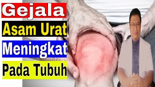 Gejala atau tanda asam urat meningkat pada tubuh