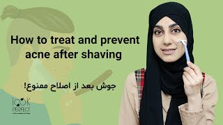 how to treat and prevent acne after shaving | جوش بعد از اصلاح ممنوع