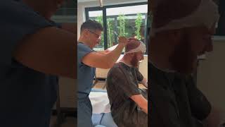 Why Head Shaving Matters Before a Hair Transplant! 🪒