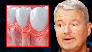 Can You ACTUALLY Regrow Receding Gums? | Dr. Mark Burhenne