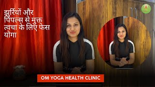 झुर्रियों और पिंपल्स से मुक्त त्वचा के लिए फेस योगा | प्राकृतिक एंटी-एजिंग और मुँहासे उपचार