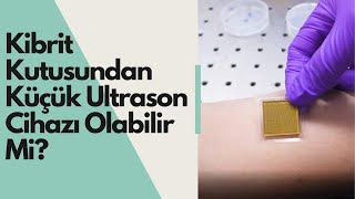 Kibrit kutusundan küçük ultrason cihazı olabilir mi?