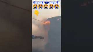 मेरा भाई जल गया 😭