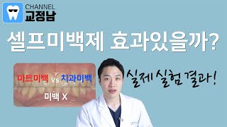 치아미백방법, 치아미백 후기, 셀프미백 효과 전후 비교! 치아미백 부작용과 치아미백제에 대해서도 알아봅시다 :)