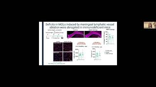 [Sofia das Neves] Meningeal lymphatic function promotes oligodendrocyte survival & brain myelination