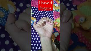 I have 4 fingers