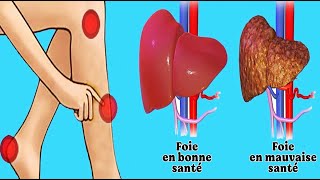 5 signes qui peuvent cacher un problème au foie