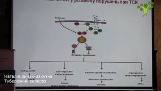 Наталія Зимак Закутня Туберозний склероз 0