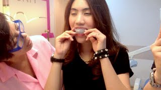 รีเทนเนอร์จัดฟันแบบพิเศษ (Tooth Positioners)