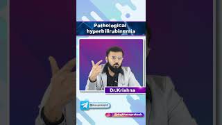 Pathological hyperbilirubinemia #drkrishna #neet #mbbskyrgyzstan #ihsm #biology #science #mbbs