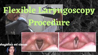 215.Flexible Laryngoscopy Procedure  #flexible laryngoscopy #endoscope #clinicalexamination