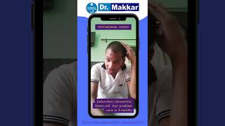 Seborrheic Dermatitis Cure: A Journey of Hope and Healing friend help friend manish nirwana haryana