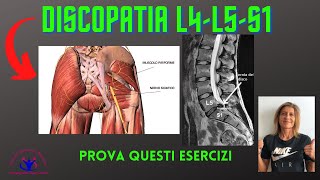 DISCOPATIA L4-L5/L5-S1 GLI ESERCIZI DI STRETCHING