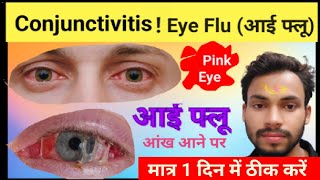 Eye Flu(आई फ्लू) Treatment। Conjunctivitis treatment। आई फ्लू का इलाज। pink eyeआंख आना। Medicin Tak