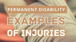 Permanent Disability Injuries