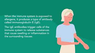 Food Allergies | Merck Manual Consumer Version