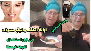 استعملي هد زيت كل ليلة وشوفي بعينك الزيت لإزالة الكلف البقع السواد وحتي التصبغات الوجه كيرجع صافي