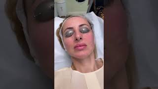 BBL Facial Treatment at EDEN Aesthetics Clinic Dubai | Brighten, Tighten & Rejuvenate Your Skin