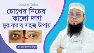 চোখের নিচের কালো দাগ দূর করার উপায় | Bangla Tips Remove dark spots | Choker Kalo Dag Dur Kora upay