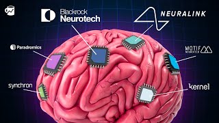 Companies Are Racing To Put A Chip In Your Brain