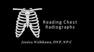 Reading Chest Radiographs in Primary Care