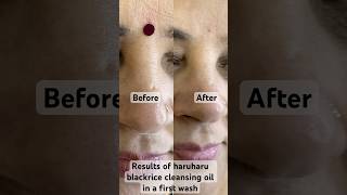 @Haruharublackricecleansingoil #koreanskincare #haruharu #shortsvideo #happyskin #shortsfeed