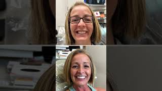 Jaw-dropping #3on6 smile transformations🤯🙌🏻🫢😍