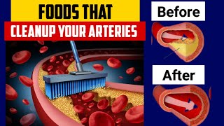 The Best Foods That Naturally Clear Your Clogged Arteries | Unclogged Your Arteries Naturally