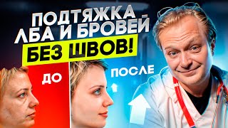 5 мифов про подтяжку без швов. Эндоскопический лифтинг