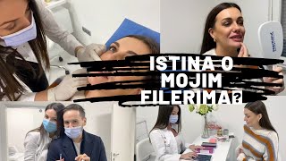 VLOG: ISTINA O MOJIM FILERIMA💉 💉 💉  | Jasmina Skender