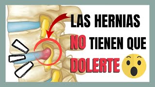 Dolor por HERNIA DISCAL😨 ¿Puedo hacer DEPORTE? ¿Se CURAN?  [DEBES SABER ESTO✅]