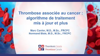 TAC Algorithme 14 sept