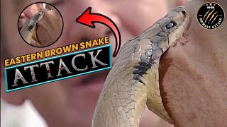 The Recent Fatal Brown Snake Bite In Queensland, Australia