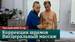 Коррекция шрамов. Висцеральный массаж. Заславский Егор