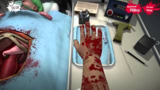 Surgeon Simulator Kindney Transplant Part 2