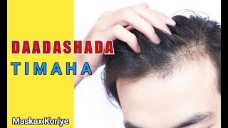 Maxaa Sababa daadashada timaha + Daawaynta | Maskax koriye