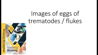 Images of Trematode Eggs