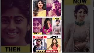 😲Shilpa Shetty Before and after pictures #shilpashetty#shorts #viral  #beforeandafter #bollywood