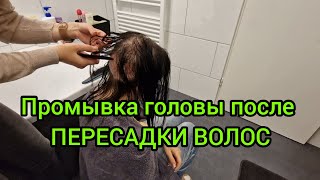 Промывка головы на 3 день после пересадки волос. Выпадение волос у женщин