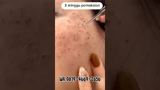 SKINCARE #skincare #fypage #fypyoutube #kreatorpemula #trending