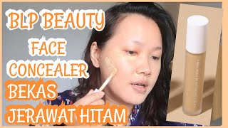 BLP FACE CONCEALER UNTUK BEKAS JERAWAT HITAM | By YmaryMy