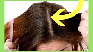 3 Homemade Anti Dandruff Recipes! Get Rid Of Dandruff Naturally In One Day!