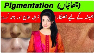 How To Get Rid Of Pigmentation Malasma/Best Cream 100% Effective/ چھائیوں کا خاتمہ