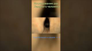 Исследование ран Ледяного человека