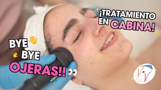 Tratamiento para OJERAS y BOLSAS DE OJOS!!