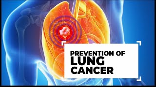 Lung Cancer Prevention | Lung Cancer Prevention and Treatment