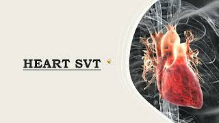 SVT....MANGEMENT OF Supraventricular tachycardia SVT