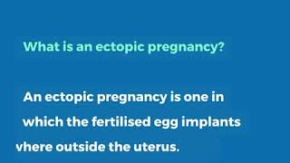 What is an ectopic pregnancy?