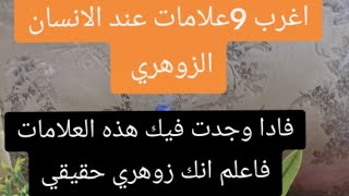 9 علامات ادا وجدت فيك فعلم انك انسان زوهري،أسرار الزوهري