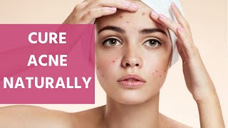 Natural Ways To Get Rid of Acne Scars Overnight